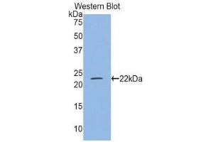 Western Blotting (WB) image for anti-Myosin Light Chain 4, Alkali, Atrial, Embryonic (MYL4) (AA 4-187) antibody (ABIN1859941) (MYL4 Antikörper  (AA 4-187))