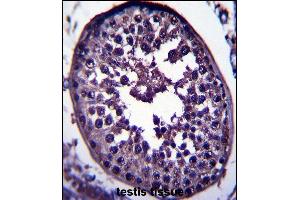 GAGE12H Antibody (N-term) (ABIN657560 and ABIN2846567) immunohistochemistry analysis in formalin fixed and paraffin embedded human testis tissue followed by peroxidase conjugation of the secondary antibody and DAB staining. (G Antigen 12H Antikörper  (N-Term))