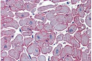 Human Heart (formalin-fixed, paraffin-embedded) stained with DCST1 antibody ABIN462239 followed by biotinylated goat anti-rabbit IgG secondary antibody ABIN481713, alkaline phosphatase-streptavidin and chromogen. (DCST1 Antikörper  (C-Term))