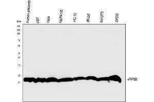 Western blot analysis of Cyclophilin B using anti-Cyclophilin B antibody (ABIN5519055).