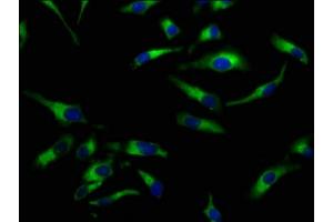 Immunofluorescence staining of Hela cells with ABIN7169960 at 1:100, counter-stained with DAPI. (SLC5A8 Antikörper  (AA 540-610))