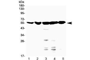 Western blot testing of 1) mouse liver, 2) mouse small intestine, 3) human HepG2, 4) human A549 and 5) human U-2 OS lysate with NR1H4 antibody at 0.