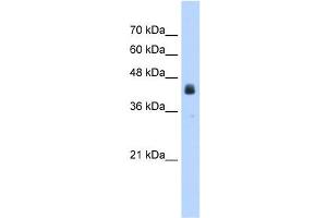 WB Suggested Anti-USAntibody Titration:  2. (USP16 Antikörper  (N-Term))