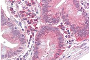 Anti-EIF2S1 antibody IHC staining of human small intestine.