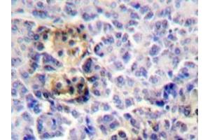 Immunohistochemistry analyzes of Moesin antibody in paraffin-embedded human pancreas tissue. (Moesin Antikörper)