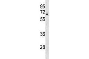 HAS3 antibody western blot analysis in A549 lysate. (HAS3 Antikörper  (AA 137-164))