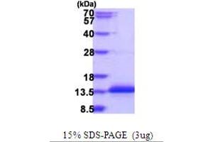 SDS-PAGE (SDS) image for Coiled-Coil Domain Containing 23 (CCDC23) (AA 1-66) protein (His tag) (ABIN5853984)
