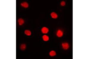 Immunofluorescent analysis of DBF4 staining in HepG2 cells. (DBF4 Antikörper  (N-Term))