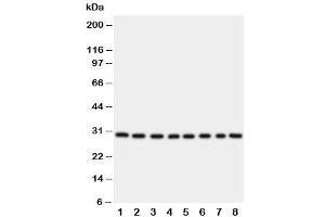 Western blot testing of TFAM (TFAM Antikörper  (C-Term))
