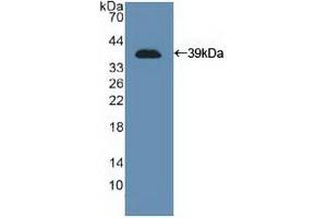 Detection of Recombinant NCAM, Human using Polyclonal Antibody to Cluster Of Differentiation 56 (CD56) (CD56 Antikörper  (AA 340-608))