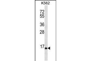 Western blot analysis in K562 cell line lysates (35ug/lane). (SPINK8 Antikörper  (C-Term))