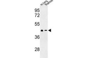 Western Blotting (WB) image for anti-Chemokine (C-X-C Motif) Receptor 7 (CXCR7) antibody (ABIN3003904)