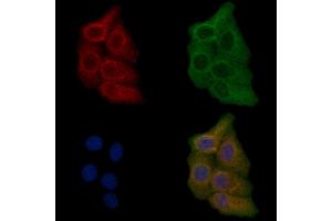 ABIN6259402 and ABIN6276172 staining Hela cells by IF/ICC.