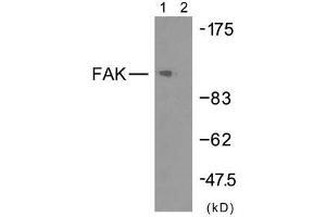 Western blot analysis of extracts from HeLa cells using FAK (Ab-925) antibody (E021148). (FAK Antikörper)