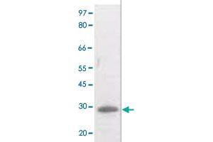The whole cell lysate derived from UV treated Raji cell was separated in 10% SDS-PAGE, transferred onto NC membrane, and immunoblotted by BCL2 (phospho T129) polyclonal antibody  at 1 : 500. (Bcl-2 Antikörper  (pThr129))