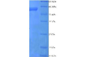 SDS-PAGE (SDS) image for Plasminogen Activator Inhibitor 2 (SERPINB2) (AA 1-416), (full length) protein (His tag) (ABIN7479048)
