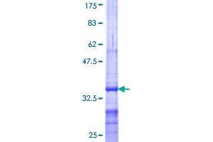 Image no. 1 for ATP-Binding Cassette, Sub-Family A (ABC1), Member 10 (ABCA10) (AA 1-80) protein (GST tag) (ABIN1305423) (ABCA10 Protein (AA 1-80) (GST tag))