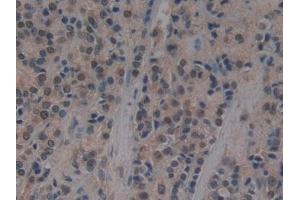 Immunohistochemistry (IHC) image for anti-Ubiquitin-Like Modifier Activating Enzyme 7 (UBA7) (AA 429-488) antibody (ABIN7433036)