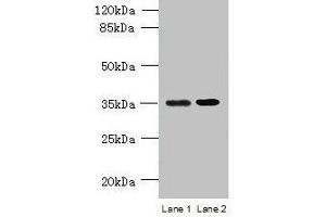Western blot All lanes: CFAP65 antibody at 8 μg/mL Lane 1: U251 whole cell lysate Lane 2: U87 whole cell lysate Secondary Goat polyclonal to rabbit IgG at 1/10000 dilution Predicted band size: 218, 19, 82, 88 kDa Observed band size: 35 kDa (CCDC108 Antikörper  (AA 2-164))
