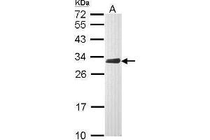WB Image Sample (30 ug of whole cell lysate) A: Raji 12% SDS PAGE antibody diluted at 1:1000 (CLIC4 Antikörper)