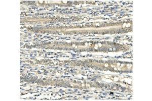 IHC analysis of BubR1/BUB1B using anti-BubR1/BUB1B antibody (ABIN7600961).