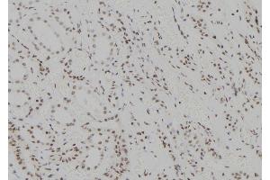 ABIN6273566 at 1/100 staining Human kidney tissue by IHC-P. (ZNF713 Antikörper)