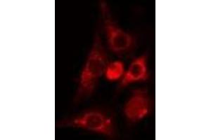 ABIN6275051 staining Hela cells by IF/ICC. (PLA2G4C Antikörper  (Internal Region))