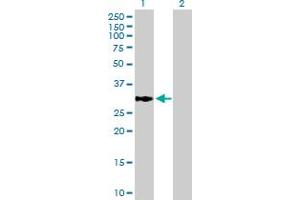 Western Blot analysis of ECHDC1 expression in transfected 293T cell line by ECHDC1 MaxPab polyclonal antibody. (ECHDC1 Antikörper  (AA 1-301))