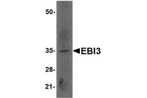 Image no. 2 for anti-Interleukin-27 subunit beta (IL-27b) (Internal Region) antibody (ABIN341721) (EBI3 Antikörper  (Internal Region))