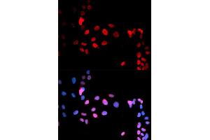 Immunofluorescence analysis of U2OS cells using Phospho-MAX-S11 antibody (ABIN5969917). (MAX Antikörper  (pSer11))