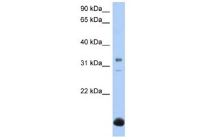 Western Blotting (WB) image for anti-UDP-Gal:betaGal beta 1,3-Galactosyltransferase Polypeptide 6 (B3GALT6) antibody (ABIN2459385) (B3GALT6 Antikörper)