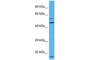 Host:  Rabbit  Target Name:  MBOAT1  Sample Tissue:  Human 786-0 Whole Cell  Antibody Dilution:  1ug/ml (MBOAT1 Antikörper  (N-Term))