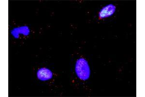 Proximity Ligation Analysis of protein-protein interactions between PARD3 and CTNNB1. (PARD3 Antikörper  (AA 1-1340))