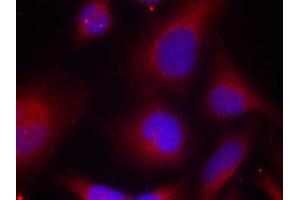Immunofluorescence staining of methanol-fixed Hela cells using Phospho-MARCKS-S158 antibody. (MARCKS Antikörper  (pSer158))