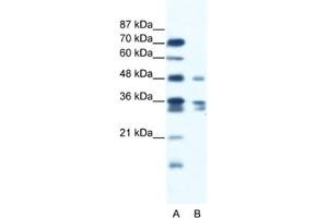 Western Blotting (WB) image for anti-Zinc Finger Protein 577 (ZNF577) antibody (ABIN2461281) (ZNF577 Antikörper)