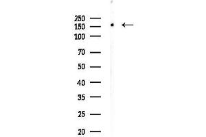 Western blot analysis of lysates from HUVEC cells, using SMRC2 Antibody at 1/1000 dilution.