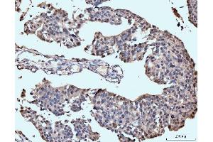 IHC analysis of Neurofibromin/NF1 using anti-Neurofibromin/NF1 antibody (ABIN7600196). (Neurofibromin 1 Antikörper  (AA 160-270))