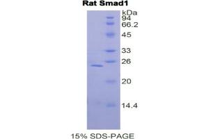 SDS-PAGE analysis of Rat Smad1 Protein. (SMAD1 Protein)
