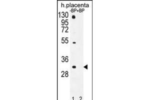 Western blot analysis of OR1D5 Antibody (C-term) Pab (ABIN655952 and ABIN2845338) pre-incubated without(lane 1) and with(lane 2) blocking peptide in human placenta tissue lysate.
