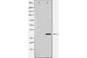 Western blot analysis of HEX293  lysate using CDCA8 antibody.