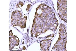 IHC analysis of CTNND1 using anti-CTNND1 antibody (ABIN7602220). (CTNND1 Antikörper  (AA 64-930))