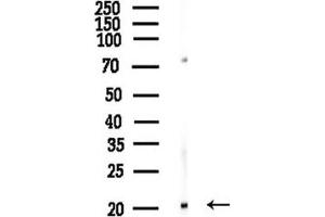 anti-DIRAS Family, GTP-Binding RAS-Like 1 (DIRAS1) (C-Term) antibody