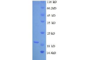 Tumor Necrosis Factor (TNF) (AA 78-234) protein (His tag)