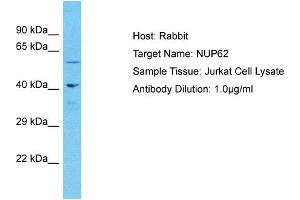 Host: Rabbit Target Name: NUP62 Sample Type: Jurkat Whole Cell lysates Antibody Dilution: 1.