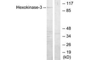 Western blot analysis of extracts from Jurkat cells, treated with insulin 0.