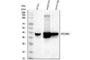 anti-Paraoxonase 1 (PON1) (AA 30-274) antibody