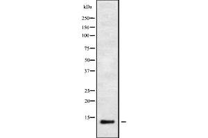Western blot analysis IFI6 using HeLa whole cell lysates (IFI6 Antikörper)