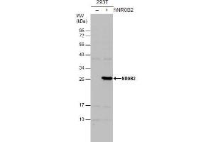 WB Image Non-transfected (–) and transfected (+) 293T whole cell extracts (30 μg) were separated by 12% SDS-PAGE, and the membrane was blotted with NR0B2 antibody [N2C3] , diluted at 1:500. (NR0B2 Antikörper)