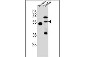 NOSTRIN Antibody (Center) (ABIN657754 and ABIN2846736) western blot analysis in mouse heart tissue and HepG2 cell line lysates (35 μg/lane).