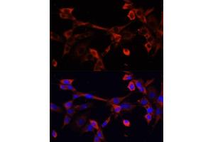 Immunofluorescence analysis of NIH/3T3 cells using DNL1 antibody (ABIN6130967, ABIN6139736, ABIN6139738 and ABIN6217037) at dilution of 1:100. (DNASEX Antikörper  (AA 1-302))